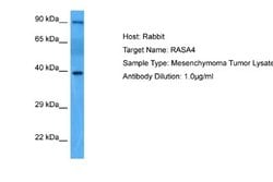 RASA4 Antibody, Novus Biologicals 100 &mu;L; Unconjugated:Antibodies, Polyclonal